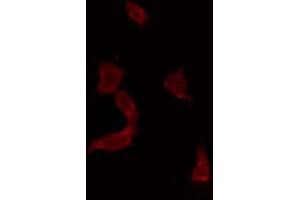 Immunofluorescence (fixed cells) (IF/ICC) image for anti-Yes-Associated Protein 1 (YAP1) antibody (ABIN6266074)