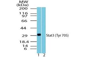 Image no. 1 for anti-Signal Transducer and Activator of Transcription 3 (Acute-Phase Response Factor) (STAT3) (pTyr705) antibody (ABIN960359) (STAT3 antibody  (pTyr705))