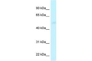 WB Suggested Anti-CPVL Antibody Titration: 1. (CPVL antibody  (Middle Region))