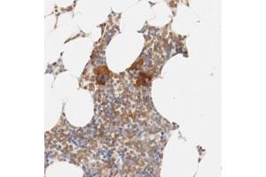 Immunohistochemical staining (Formalin-fixed paraffin-embedded sections) of human bone marrow with ZNF267 polyclonal antibody  shows strong cytoplasmic positivity in a subset of bone marrow poietic cells (megakaryocytes).