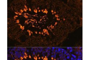 Immunofluorescence analysis of Rat testis using AKAP4 Polyclonal Antibody at dilution of 1:100. (AKAP4 antibody)