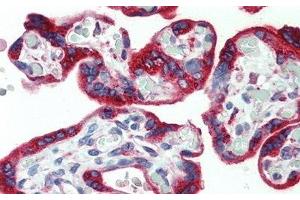 Detection of PDGFAA in Human Placenta Tissue using Monoclonal Antibody to Platelet Derived Growth Factor AA (PDGFAA) (PDGF-AA Homodimer (AA 87-211) antibody)