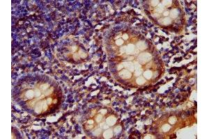 IHC image of ABIN7157812 diluted at 1:200 and staining in paraffin-embedded human appendix tissue performed on a Leica BondTM system. (LARP6 antibody  (AA 294-453))