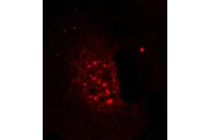 Immunofluorescence staining of methanol-fixed Hela cells showing nuclear dot staining using Akt(Phospho-Thr308) Antibody. (AKT1 antibody  (pThr308))
