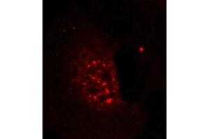 Immunofluorescence staining of methanol-fixed Hela cells showing nuclear dot staining using Akt(Phospho-Thr308) Antibody. (AKT1 antibody  (pThr308))