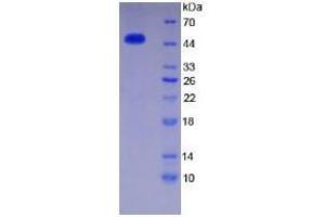 SDS-PAGE analysis of Human Thrombin Protein. (SERPINC1 Protein)