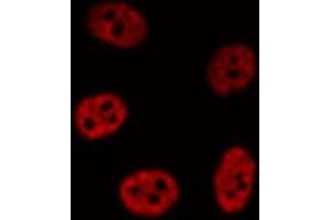 ABIN6276911 staining HepG2? (NR0B2 antibody  (Internal Region))