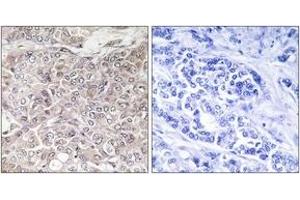 Immunohistochemistry (IHC) image for anti-GPRIN Family Member 3 (GPRIN3) (AA 131-180) antibody (ABIN1534920)