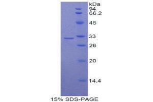 SDS-PAGE (SDS) image for Myosin IC (MYO1C) (AA 728-987) protein (His tag) (ABIN2121684) (Myosin IC Protein (MYO1C) (AA 728-987) (His tag))
