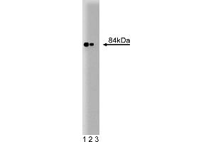 Western Blotting (WB) image for anti-Stromal Interaction Molecule 1 (STIM1) (AA 25-139) antibody (ABIN968271) (STIM1 antibody  (AA 25-139))
