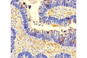 CCDC66 antibody  (AA 87-286)