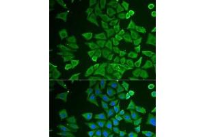 Immunofluorescence analysis of U2OS cells using DDAH2 Polyclonal Antibody (DDAH2 antibody)