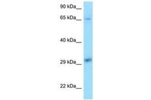 Image no. 1 for anti-Xeroderma Pigmentosum, Complementation Group A (XPA) (C-Term) antibody (ABIN6748095) (XPA antibody  (C-Term))
