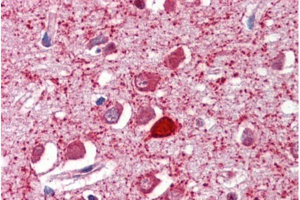 PVALB antibody  (C-Term)