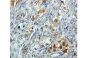 IHC-P analysis of Ovary tissue, with DAB staining. (TNFRSF10B antibody  (AA 234-435))