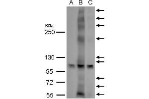 WB Image GPR30 antibody detects GPR30 protein by western blot analysis. (GPER antibody  (C-Term))