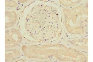 Immunohistochemistry of paraffin-embedded human kidney tissue using ABIN7167403 at dilution of 1:100 (RAP2B antibody  (AA 1-183))