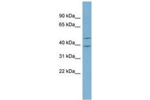 Image no. 1 for anti-Actin-Like 6B (ACTL6B) (AA 323-372) antibody (ABIN6741899) (Actin-Like 6B antibody  (AA 323-372))