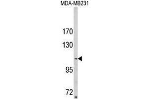 Western blot analysis of ARGBP2 Antibody (N-term) in MDA-MB231 cell line lysates (35ug/lane).