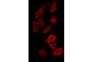 Immunofluorescence (fixed cells) (IF/ICC) image for anti-Topoisomerase (DNA) II alpha 170kDa (TOP2A) (Internal Region) antibody (ABIN6265673)