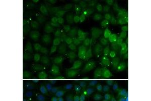 Immunofluorescence analysis of U2OS cells using HPD Polyclonal Antibody (HPD antibody)