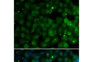Immunofluorescence analysis of U2OS cells using HPD Polyclonal Antibody (HPD antibody)
