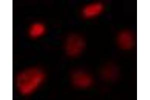 ABIN6274308 staining Hela cells by IF/ICC. (Foxk1 antibody  (Internal Region))