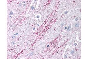 Anti-GDI2 antibody IHC of human brain, cortex. (GDI2 antibody  (AA 361-410))