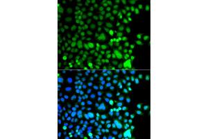 Immunofluorescence analysis of A549 cells using AEBP2 antibody (ABIN5975286). (AEBP2 antibody)