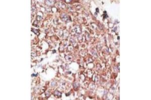 Image no. 2 for anti-Lymphatic Vessel Endothelial Hyaluronan Receptor 1 (LYVE1) (AA 250-279), (C-Term) antibody (ABIN357392) (LYVE1 antibody  (C-Term))