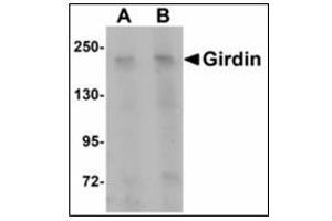 Western blot analysis of Girdin in rat brain tissue lysate with Girdin antibody at (A) 1 and (B) 2 µg/ml. (Girdin antibody  (C-Term))