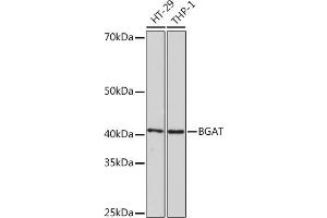 Western blot analysis of extracts of various cell lines, using BGAT Rabbit mAb (ABIN7267664) at 1:1000 dilution. (ABO antibody)