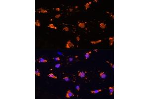 Immunofluorescence analysis of L929 cells using CD172a/SIRPα Rabbit pAb (ABIN6130058, ABIN6147780, ABIN6147781 and ABIN6224854) at dilution of 1:100 (40x lens). (SIRPA antibody  (AA 395-504))