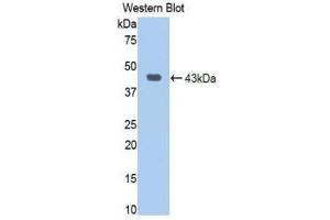 Western Blotting (WB) image for anti-Jagged 1 (JAG1) (AA 470-834) antibody (ABIN1859516) (JAG1 antibody  (AA 470-834))