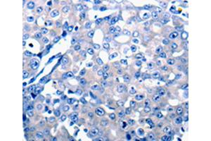 Immunohistochemistry (IHC) image for anti-Chemokine (C-C Motif) Ligand 2 (CCL2) antibody (ABIN2425646) (CCL2 antibody)