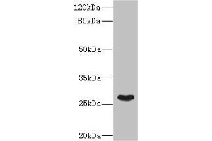 Western blot All lanes: FAM122B antibody at 5 μg/mL + Mouse brain tissue Secondary Goat polyclonal to rabbit IgG at 1/10000 dilution Predicted band size: 27, 28, 30, 20 kDa Observed band size: 27 kDa (FAM122B antibody  (AA 2-247))