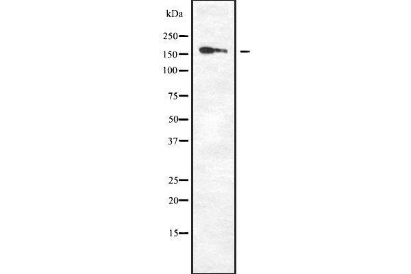 DAP Kinase 1 antibody  (Internal Region)