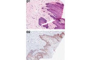 Immunohistochemistry (IHC) image for anti-Programmed Cell Death 4 (PDCD4) (pSer457) antibody (ABIN129708)