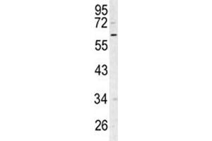 Western blot analysis of RIPK3 antibody and Ramos lysate. (RIPK3 antibody  (AA 1-30))