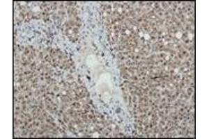 Immunohistochemistry (IHC) image for anti-Nitric Oxide Synthase 2, Inducible (NOS2) antibody (ABIN870301) (NOS2 antibody)