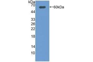 Detection of Recombinant DIO2, Rat using Polyclonal Antibody to Deiodinase, Iodothyronine, Type II (DIO2) (DIO2 antibody  (AA 30-259))