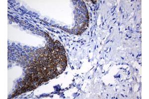 Image no. 8 for anti-NADH Dehydrogenase (Ubiquinone) 1 beta Subcomplex, 10, 22kDa (NDUFB10) antibody (ABIN1499672) (NDUFB10 antibody)