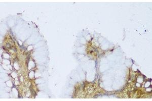 Immunohistochemistry of paraffin-embedded Human stomach using GCN1L1 Polyclonal Antibody at dilution of 1:150 (40x lens). (GCN1L1 antibody)