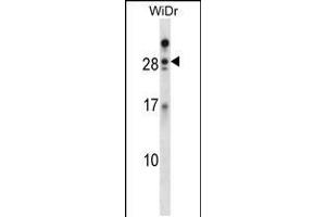 Western blot analysis in WiDr cell line lysates (35ug/lane). (Azurocidin antibody  (AA 67-96))