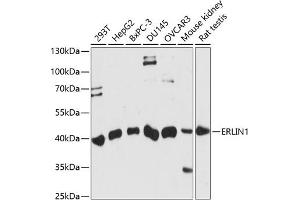 Western blot analysis of extracts of various cell lines, using ERLIN1 antibody (ABIN7267005) at 1:1000 dilution.