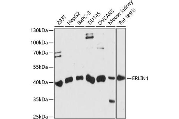 ERLIN1 Antikörper  (AA 259-348)