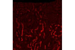 Fig A: ABIN7013885 (2. (SLC5A1 antibody  (Internal Region))