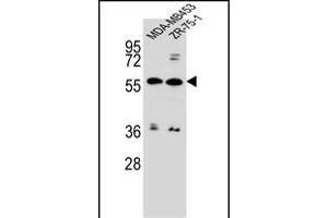 ABCG4 Antibody (N-term) (ABIN656651 and ABIN2845892) western blot analysis in MDA-M,ZR-75-1 cell line lysates (35 μg/lane). (ABCG4 antibody  (N-Term))