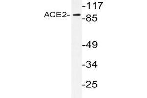 Western blot (WB) analyzes of ACE2 antibody in extracts from HeLa cells. (ACE2 antibody)