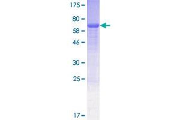 DGCR14 Protein (AA 1-395) (GST tag)